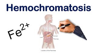 Hemochromatosis  USMLE COMLEX NCLEX [upl. by Heinrike]