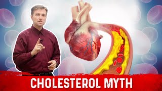 The Cholesterol Myths amp Facts [upl. by Burnard]