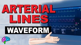 The Arterial Line Waveform EXPLAINED [upl. by Kaliope567]