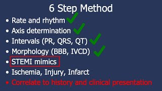 Basic Arrhythmias  Sinus Brady Tachy Premature Beats  ECG EKG Interpretation Part 3 [upl. by Siva]