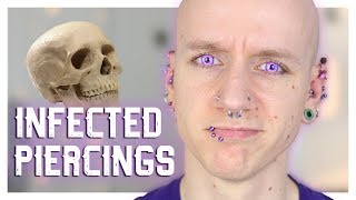 Infected Piercings amp How To Heal Them  Piercing FAQ 21  Roly [upl. by Dietrich]