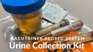 Vacutainer Urine Collection [upl. by Yursa]