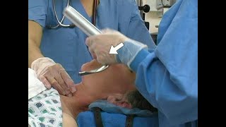 Orotracheal Intubation [upl. by Cicero216]