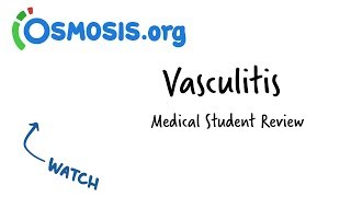 Vasculitis  Clinical Presentation [upl. by Toscano611]