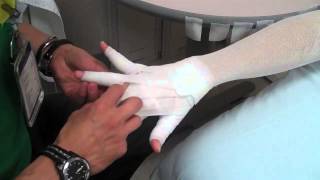 Arm Lymphedema wrapping [upl. by Hada749]