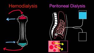 Basics of Dialysis and Modalities [upl. by Aileno]