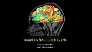 fMRI BrainScan SideView [upl. by Reimer348]