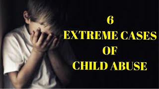 6 Extreme Cases of Child Abuse [upl. by Ander993]