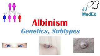 Albinism  Genetics Different Types and What You Need to Know [upl. by Notsej]