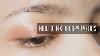 How to Fix Droopy Eyelids [upl. by Notyrb555]