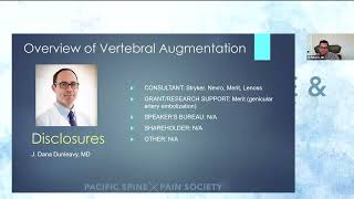 PSPS Webinar Vertebral Augmentation [upl. by Shea]