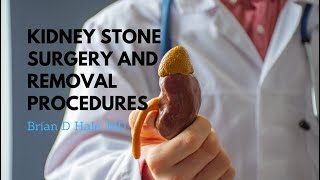 Kidney Stone Surgery amp Removal Procedures  Dr Brian D Hale [upl. by Ziana]