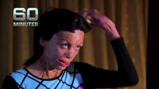 TURIA PITT  60 MINUTES [upl. by Femmine]