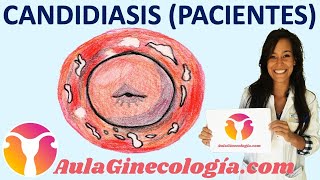 CANDIDIASIS VAGINAL PACIENTES Causas síntomas tratamiento  Ginecología y Obstetricia [upl. by Bathsheba]