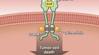 Osimertinib in Advanced Non–SmallCell Lung Cancer [upl. by Leinto161]