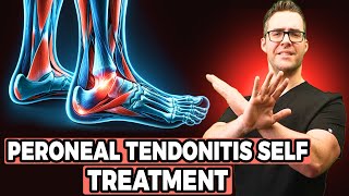 Peroneal Tendonitis Self Treatment Stretches Exercises amp Massage [upl. by Eenoj]