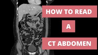 How to read a CT Abdomen for Med students and Residents  Part 1 [upl. by Chubb]