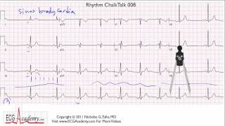 EKG Basics  How to Read amp Interpret EKGs Updated Lecture [upl. by Aserehs]