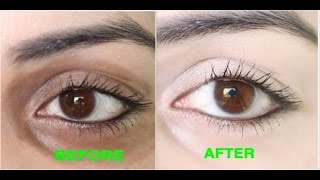 How to Remove Dark Circles Naturally in 3 Days 100 Results [upl. by Tillford]