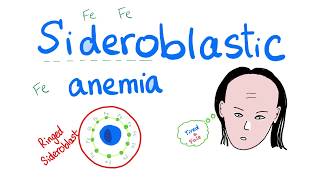 Sideroblastic Anemia [upl. by Uyr]