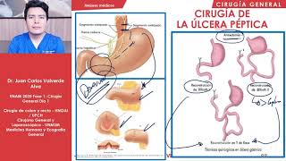 CIRUGÍA  Patología de estómago 1  ENAM 2020 [upl. by Ailyt832]
