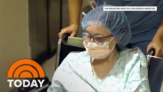 Survivor Of Conjoined Twin Surgery Gives Birth To Her Own Baby [upl. by Stultz783]