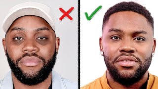 Remove DARK CIRCLES Under Your Eyes How I Did It Mens Skin Care [upl. by Trueblood803]