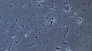 Bacteria of dental plaque under the microscope [upl. by Celesta]