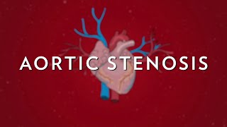 Inferior Mesenteric Artery  Anatomy Tutorial [upl. by Bohon]