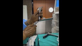 MLS microlaryngoscopy procedure [upl. by Zuleika]