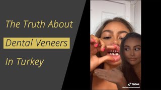 The Truth about Dental Veneers in Turkey [upl. by Irra]