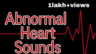 Abnormal Heart Sounds  MisMedicine [upl. by Alecia204]