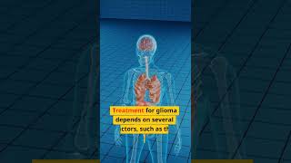 Treatment Options for Glioma Including Homeopathy [upl. by Guild]