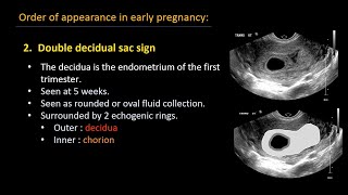 Video 13 Positive sliding sign anteverted [upl. by Eugenides]