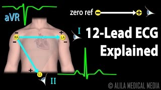 12 Lead ECG Explained Animation [upl. by Anabella]