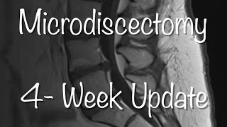 Microdiscectomy Recovery  4 Weeks [upl. by Cadell231]