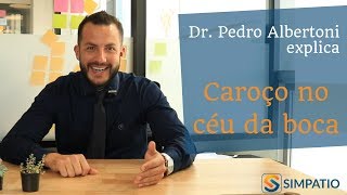 CAROÇO NO CÉU DA BOCA CONHEÇA AS CAUSAS com Dr Pedro Albertoni [upl. by Nowujalo]