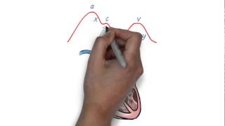 JVP waveform explained [upl. by Hanser]