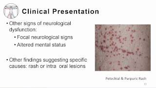 1 Overview meningitis and encephalitis [upl. by Mixie73]