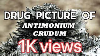 Drug picture of Antimonium crudum [upl. by Oloap]