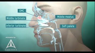 Brain Anatomy  Brain Fornix and Ventricle Anatomy [upl. by Widera]