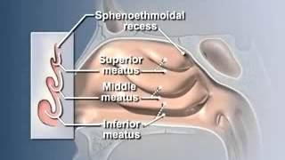 How Does Nasal amp Sinus Irrigation Work  shortened version [upl. by Wernick459]