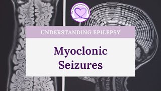 What are Myoclonic Seizures [upl. by Lleon837]