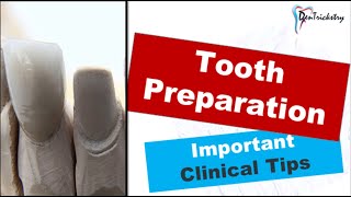 CLINICAL TIPS for TOOTH PREPARATIONCROWN PREPARATION [upl. by Bilow]