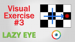 Lazy Eye Exercise 03 [upl. by Kari]