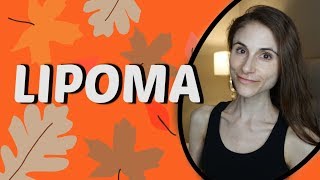 LIPOMA CAUSES TREATMENTS REMEDIES QampA WITH DERMATOLOGIST DR DRAY [upl. by Polash]