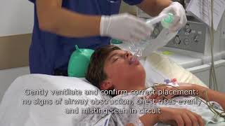 Intubation Procedure – Anesthesiology  Lecturio [upl. by Harifaz]