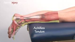 Achilles Tendonitis  Tendinopathy  Explained in 90 Seconds [upl. by Eveline735]