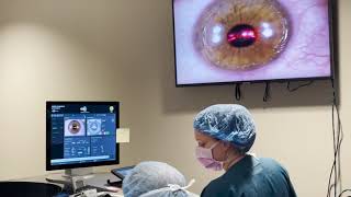 Refractive Surgery Platform Wavefront Science [upl. by Enowtna]