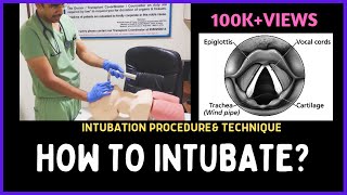 Endotracheal Intubation Animated [upl. by Hare]